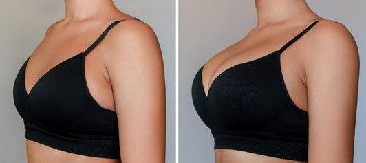 Perfect Shape Breast Ehancement Cream