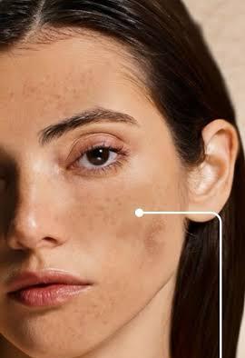 Dull Skin